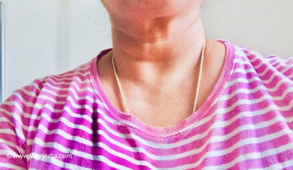 Thyroid Problems