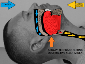 SNORING: HOW TO STOP SNORING FOR BETTER HEALTH
