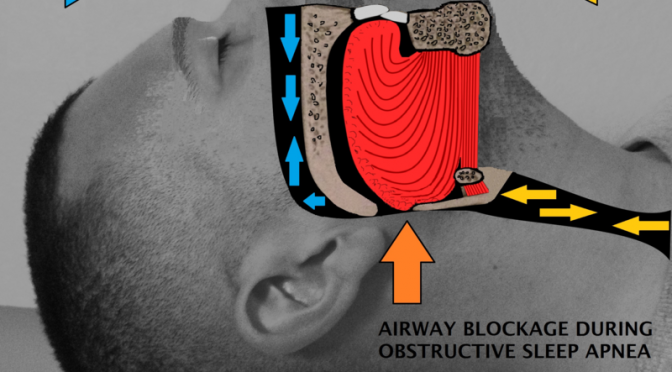 SNORING: HOW TO STOP SNORING FOR BETTER HEALTH