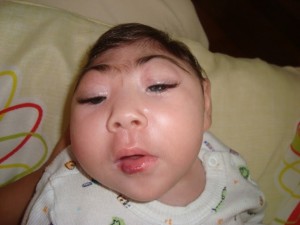 Virus Causing Babies to Have Small Heads Making Way to US; Countries Say Don’t Get Pregnant