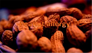 Peanuts Allergy