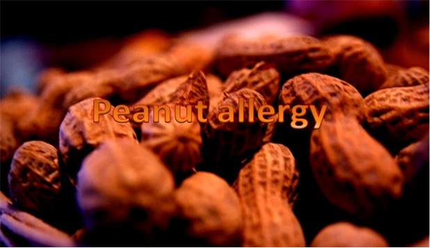 Peanuts Allergy