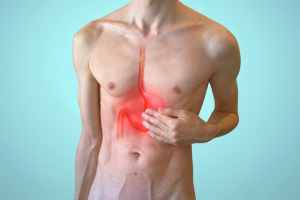 Gastric Type Gut