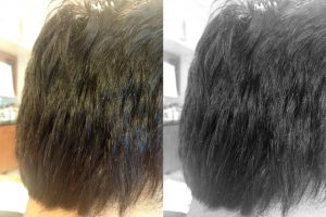Home Remedies For Dandruff
