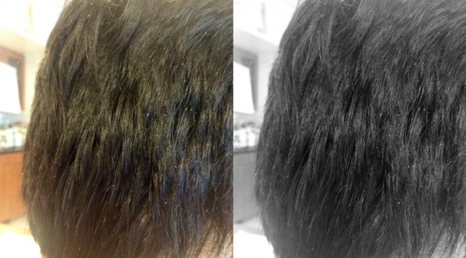 Home Remedies For Dandruff