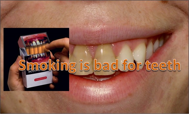 Avoid Tobacco