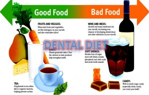 Dental Diet