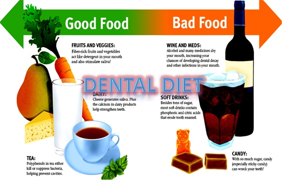 Dental Diet