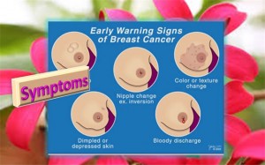 Symptoms of breast cancer
