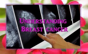 Understanding Breast Cancer