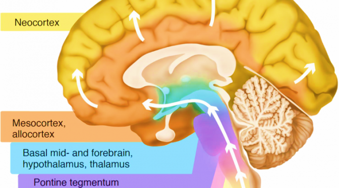 Alzheimer's Awareness Month