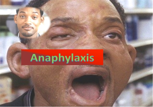 Anaphylaxis