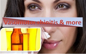 Vasomotor Rhinitis & more