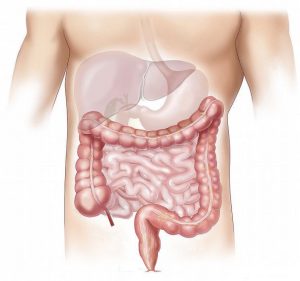 March - Colon Cancer Awareness Month
