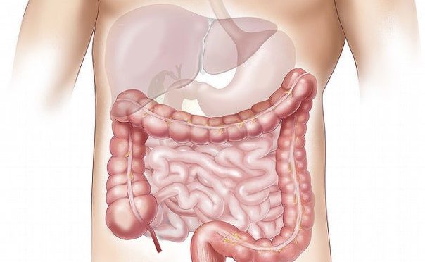 March - Colon Cancer Awareness Month