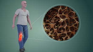 How To Boost Your Bone Health According To Your Age Group?