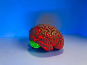 Brain age may predict the early death