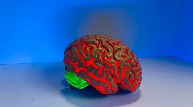 Brain age may predict the early death