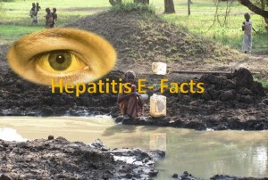 Hepatitis E virus