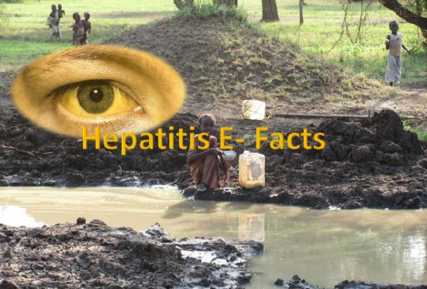 Hepatitis E virus