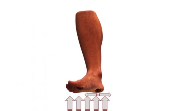 Diabetic foot care tips
