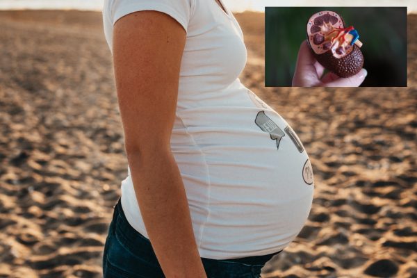 Lupus symptoms and treatment