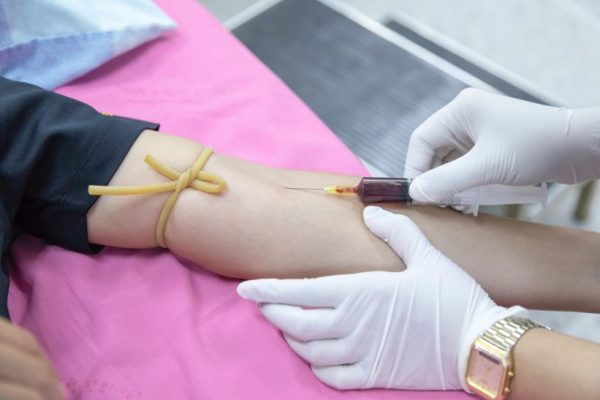 Blood group A converted to universal donor