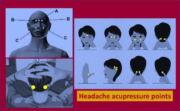Acupressure for headache