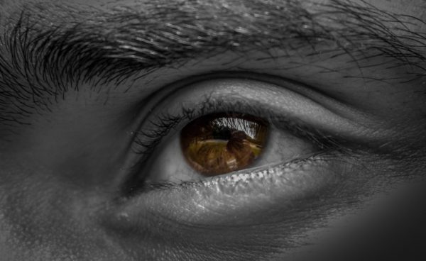 Under eye bag removal