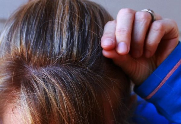 Remedies for premature hair greying