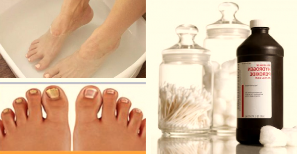 Hydrogen peroxide hacks