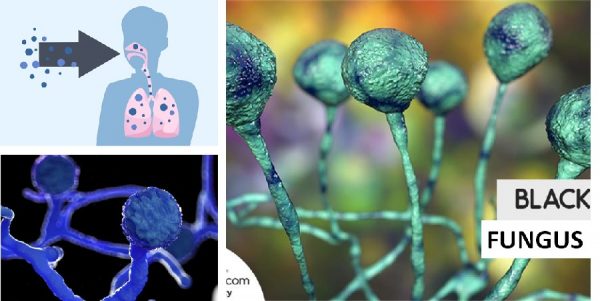 Black fungus guidelines