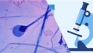 Diagnosis of Mucormycosis