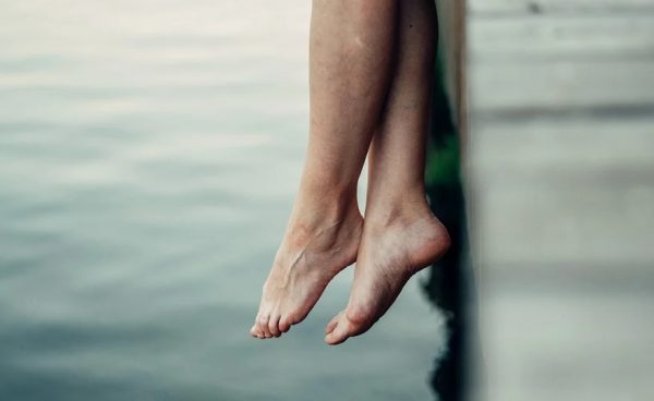 Varicose veins remedies