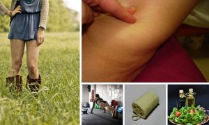 Cellulite remedies