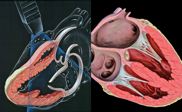 What are the tests that help us to determine our heart health?