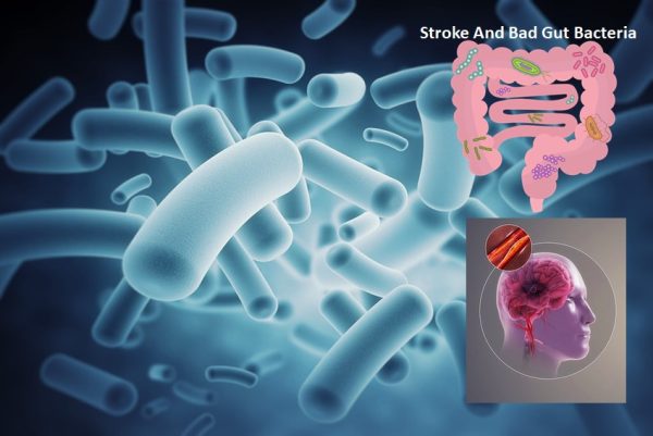 Bad gut bacteria and stroke