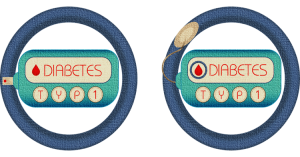 Diabetes High blood sugar