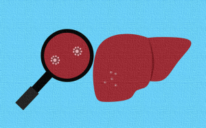 Hepatitis Infection of Liver