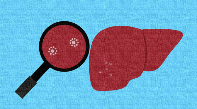 Hepatitis Infection of Liver