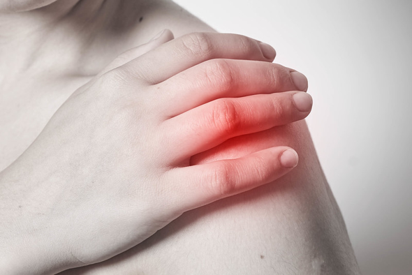How long Myositis lasts?