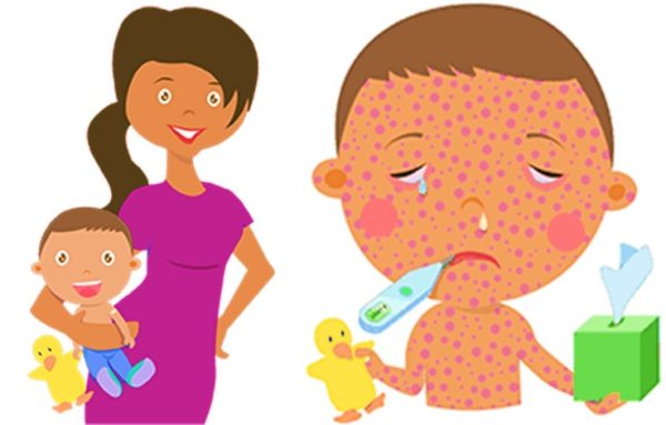 Measles outbreak