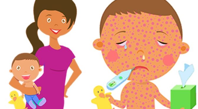 Measles outbreak