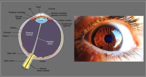 Retinal detachment