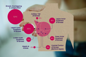 Understanding Breast Cancer Risk Factors And Prevention Strategy