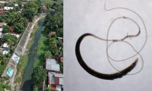 Poor sanitation and Whipworm infection