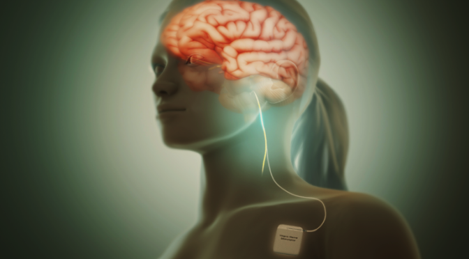 What is Vagal Tone And Factors Influencing Vagal Tone