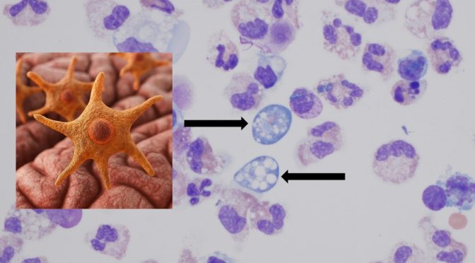 Brain eating amoeba