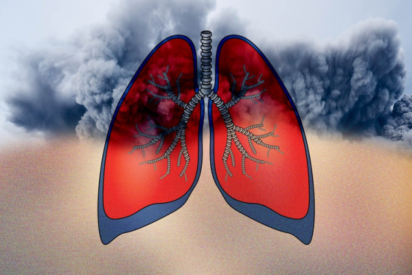 Asthma -Triggers, Prevention, Lifestyle And Tips To Use Inhalers